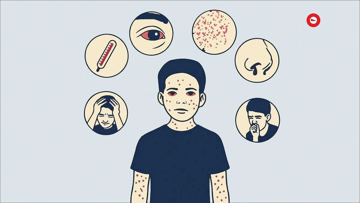 Measles spreading from hospitals