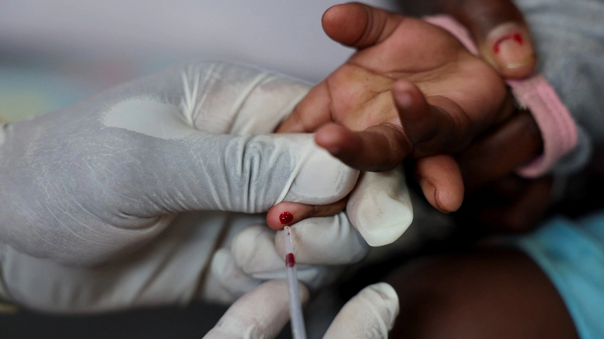 US Ends HIV Funding for South Africa