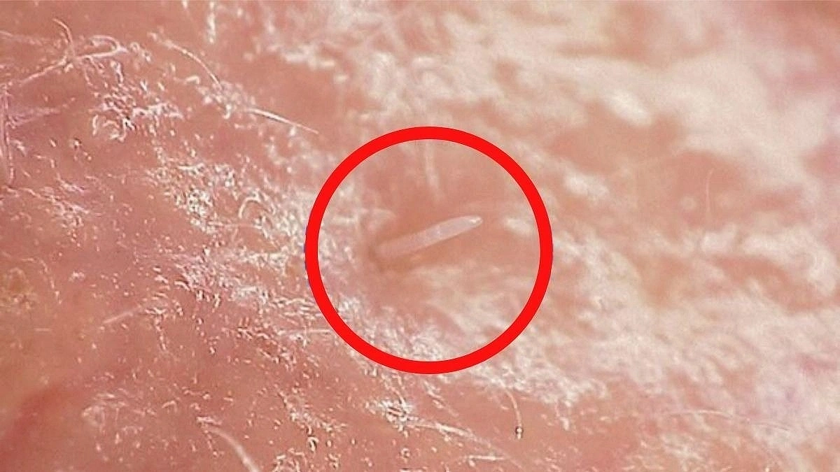 The Tiny Creatures That Never Leave Your Side